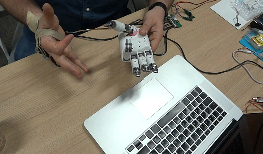 Протез на основе ИИ